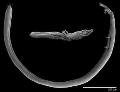 Nematalycids Gordialycus sp & Cunliffea strenzkei